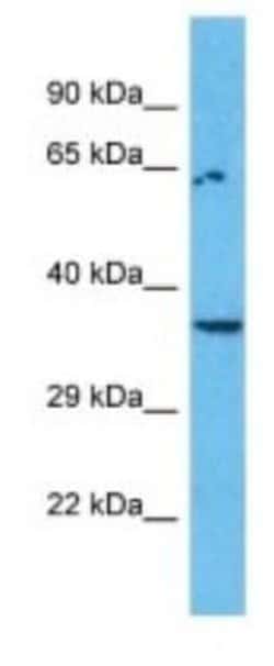 OR8I2 Rabbit anti-Human, Polyclonal, Novus Biologicals:Antibodies:Primary